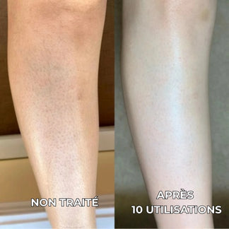 Purixa Velours — Soin Corps Lissant Anti-« Peau de Fraise »