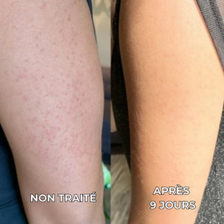 Purixa Velours — Soin Corps Lissant Anti-« Peau de Fraise »