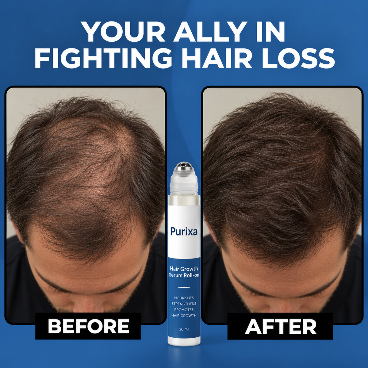 Hair Density Roll-On Serum